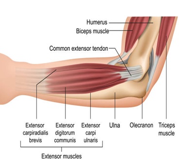 Golfer’s Elbow (Medial Epicondylitis) treatment in trivandrum