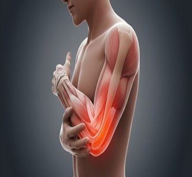 Golfer’s Elbow (Medial Epicondylitis) specialist